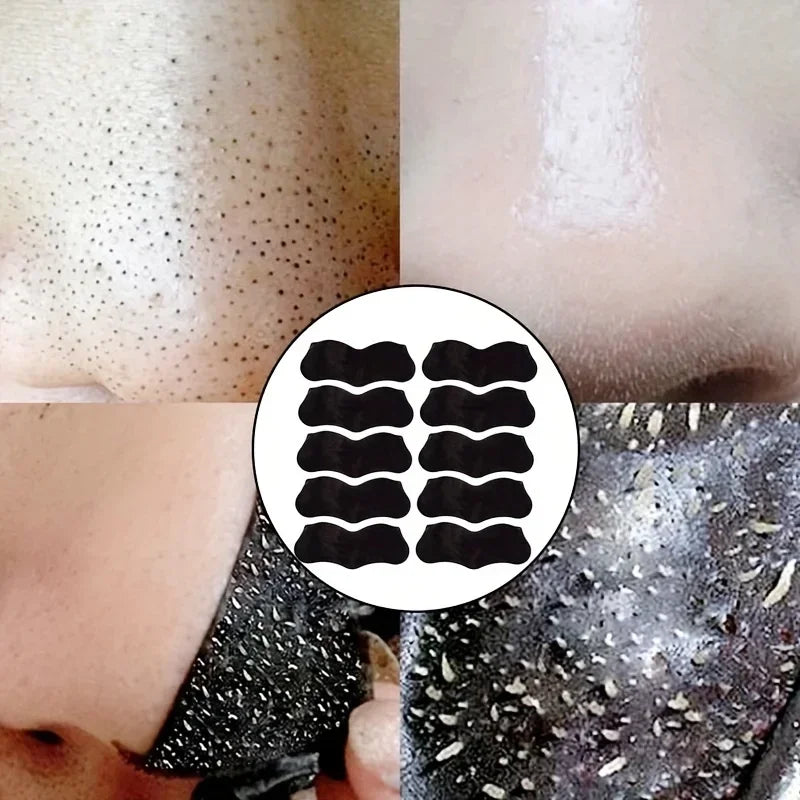 15pcs Blackhead Nose Strips
