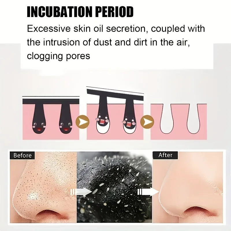 15pcs Blackhead Nose Strips